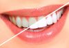 Albește-ți dinții mult mai ușor și fără durere cu noile tehnologii