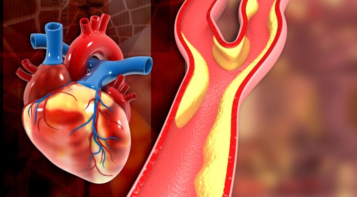 12 metode prin care poţi preveni apariţia unui infarct miocardic