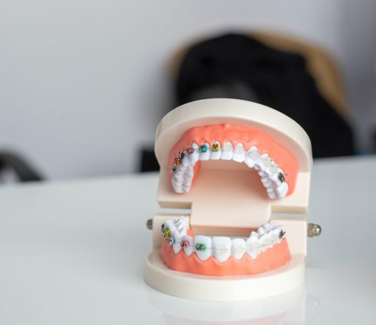 Cum să te pregătești pentru prima vizită la ortodont?