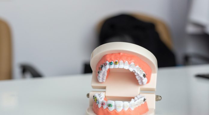 Cum să te pregătești pentru prima vizită la ortodont?